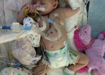 picture of Leah about a week after heart surgery as a 5 month old. she is still hooked up to multiple monitoring devices and receiving oxygen.